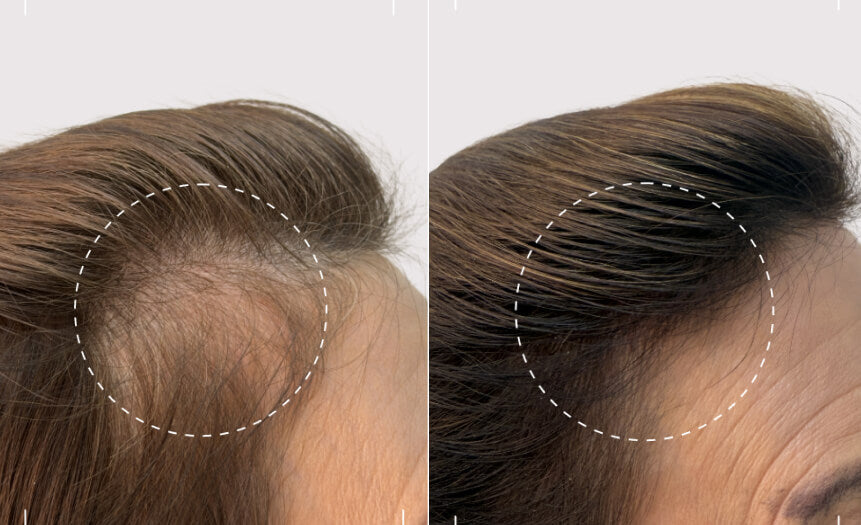 Before and after comparison