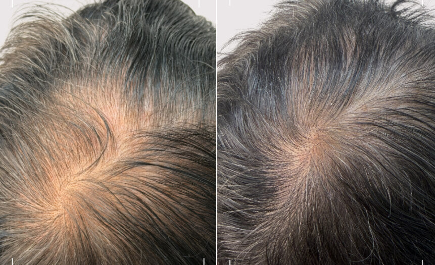 Before and after comparison