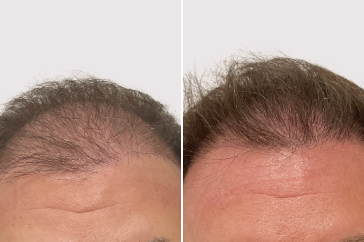 Before and after comparison