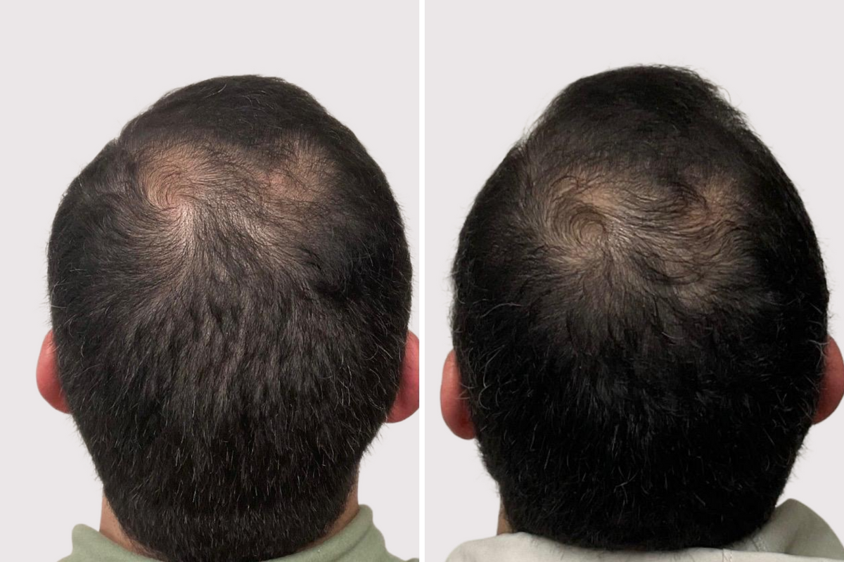 Before and after comparison